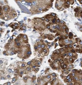 Immunohistochemistry: CYB5R3 Antibody (8H0) [NBP3-42953] - Immunohistochemistry of paraffin-embedded human liver using (CYB5R3 antibody) at dilution of 1:50