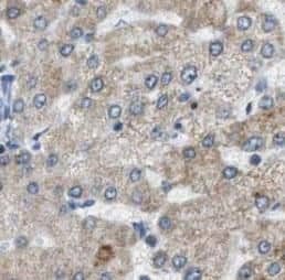 Immunohistochemistry: Cytoglobin Antibody (7F6) [NBP3-42955] - Immunohistochemistry of paraffin-embedded human liver using (Cytoglobin antibody) at dilution of 1:50