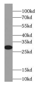 Western Blot Cytoglobin Antibody (7F6)