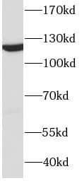 Western Blot: DDB1 Antibody (3A0) [NBP3-42957] - HeLa cells were subjected to SDS PAGE followed by western blot with (DDB1 antibody) at dilution of 1:1000