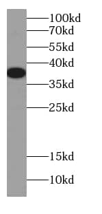 Western Blot: DNAJB2 Antibody (2H8) [NBP3-42958] - K-562 cells were subjected to SDS PAGE followed by western blot with (DNAJB2 antibody) at dilution of 1:300