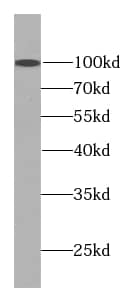 Western Blot: SART2 Antibody (3G11) [NBP3-42959] - COLO 320 cells were subjected to SDS PAGE followed by western blot with (SART2 antibody) at dilution of 1:300