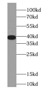 Western Blot: EEF1D Antibody (6D9) [NBP3-42962] - Jurkat cells were subjected to SDS PAGE followed by western blot with (EEF1D Antibody) at dilution of 1:1000