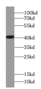 Western Blot: EEF1D Antibody (0H1) [NBP3-42963] - Jurkat cells were subjected to SDS PAGE followed by western blot with (EEF1D Antibody) at dilution of 1:1000