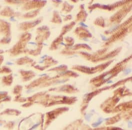 Immunohistochemistry: EPLIN Antibody (1D0) [NBP3-42966] - Immunohistochemistry of paraffin-embedded human heart using (EPLIN antibody) at dilution of 1:50