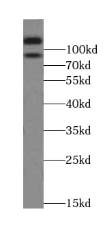 Western Blot: EPLIN Antibody (1D0) [NBP3-42966] - COLO 320 cells were subjected to SDS PAGE followed by western blot with (EPLIN antibody) at dilution of 1:1000