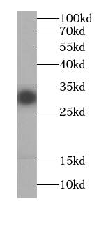 Western Blot: RRP4 Antibody (6E9) [NBP3-42968] - Jurkat cells were subjected to SDS PAGE followed by western blot with (RRP4 antibody) at dilution of 1:1000