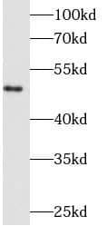 Western Blot: Fibrinogen beta chain Antibody (6F4) [NBP3-42970] - human heart tissue were subjected to SDS PAGE followed by western blot with (Fibrinogen beta chain antibody at dilution of 1:1000