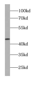 Western Blot FUT9 Antibody (2B6)