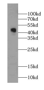 Western Blot: GDI2 Antibody (0B10) [NBP3-42973] - HepG2 cells were subjected to SDS PAGE followed by western blot with (GDI2 antibody) at dilution of 1:1000