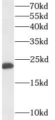 Western Blot: GM2A Antibody (9C9) [NBP3-42975] - Hela cells were subjected to SDS PAGE followed by western blot with (GM2A Antibody) at dilution of 1:500