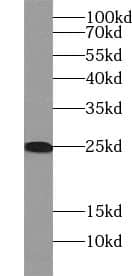 Western Blot: Membrin Antibody (8G6) [NBP3-42976] - HeLa cells were subjected to SDS PAGE followed by western blot with (Membrin antibody) at dilution of 1:1000