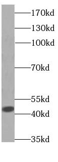 Western Blot: Aspartate Aminotransferase Antibody (2F1) [NBP3-42977] - human brain tissue were subjected to SDS PAGE followed by western blot with (Aspartate Aminotransferase Antibody) at dilution of 1:1000