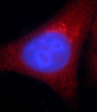 Immunocytochemistry/ Immunofluorescence: alcohol dehydrogenase 5 Antibody (3E7) [NBP3-42978] - Immunofluorescent analysis of HepG2 cells using (alcohol dehydrogenase 5 antibody) at dilution of 1:50 and Rhodamine-Goat anti-Mouse IgG