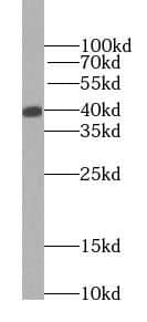 Western Blot: alcohol dehydrogenase 5 Antibody (3E7) [NBP3-42978] - fetal human brain tissue were subjected to SDS PAGE followed by western blot with (alcohol dehydrogenase 5 Antibody) at dilution of 1:4000