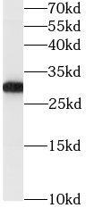 Western Blot: GSTO1 Antibody (9H4) [NBP3-42979] - human heart tissue were subjected to SDS PAGE followed by western blot with (GSTO1 Antibody) at dilution of 1:3000