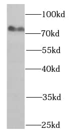 Western Blot: HADHA Antibody (6A0) [NBP3-42980] - A375 cells were subjected to SDS PAGE followed by western blot with (HADHA antibody) at dilution of 1:1000