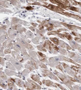 Immunohistochemistry: HADHA Antibody (6A0) [NBP3-42980] - Immunohistochemistry of paraffin-embedded human heart using (HADHA antibody) at dilution of 1:50