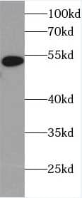 Western Blot: Heparanase/HPSE Antibody (0C0) [NBP3-42982] - HepG2 cells were subjected to SDS PAGE followed by western blot with (Heparanase/HPSE Antibody) at dilution of 1:2000