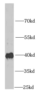 Western Blot: IGBP1 Antibody (6E3) [NBP3-42985] - K-562 cells were subjected to SDS PAGE followed by western blot with (IGBP1 antibody) at dilution of 1:1000