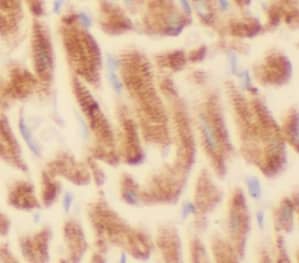 Immunohistochemistry: IGBP1 Antibody (6E3) [NBP3-42985] - Immunohistochemistry of paraffin-embedded human heart tissue slide using (IGBP1 Antibody) at dilution of 1:200