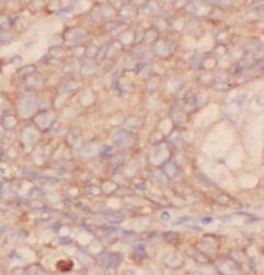 Immunohistochemistry: IVD Antibody (5F5) [NBP3-42986] - Immunohistochemistry of paraffin-embedded human liver using (IVD antibody) at dilution of 1:50