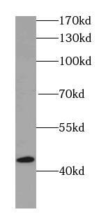 Western Blot: IVD Antibody (5F5) [NBP3-42986] - HeLa cells were subjected to SDS PAGE followed by western blot with (IVD antibody) at dilution of 1:1000