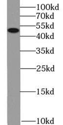 Western Blot: KCNN4 Antibody (8A11) [NBP3-42987] - human blood tissue were subjected to SDS PAGE followed by western blot with (KCNN4 Antibody) at dilution of 1:1000