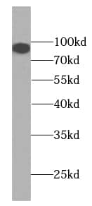 Western Blot: KIFAP3 Antibody (0H5) [NBP3-42988] - human testis tissue were subjected to SDS PAGE followed by western blot with (KIFAP3 antibody) at dilution of 1:1000