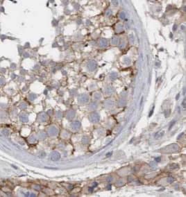 Immunohistochemistry: KIFAP3 Antibody (0H5) [NBP3-42988] - Immunohistochemistry of paraffin-embedded human testis tissue slide using (KIFAP3 Antibody) at dilution of 1:50