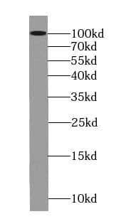 Western Blot: LONP1 Antibody (9H10) [NBP3-42990] - Jurkat cells were subjected to SDS PAGE followed by western blot with (LONP1 Antibody) at dilution of 1:5000