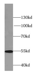 Western Blot: LPCAT1 Antibody (7E4) [NBP3-42991] - PC-12, C6, Raw264.7, NIH/3T3 cells were subjected to SDS PAGE followed by western blot with (LPCAT1 Antibody) at dilution of 1:10000