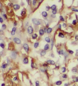 Immunohistochemistry LPCAT1 Antibody (7E4)