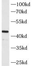 Western Blot: MAGEA3 Antibody (4E9) [NBP3-42992] - mouse brain tissue were subjected to SDS PAGE followed by western blot with (MAGEA3 Antibody) at dilution of 1:2000