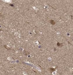 Immunohistochemistry: Monoamine Oxidase B Antibody (8E0) [NBP3-42993] - Immunohistochemistry of paraffin-embedded human brain tissue slide using (Monoamine Oxidase B Antibody) at dilution of 1:50