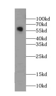 Western Blot: Monoamine Oxidase B Antibody (8E0) [NBP3-42993] - human brain tissue were subjected to SDS PAGE followed by western blot with (Monoamine Oxidase B antibody) at dilution of 1:1000