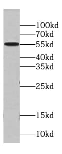 Western Blot: MCRS1 Antibody (5G3) [NBP3-42995] - SKOV-3 cells were subjected to SDS PAGE followed by western blot with (MCRS1 antibody) at dilution of 1:1000