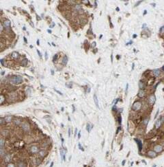 Immunohistochemistry MEST Antibody (5E0)