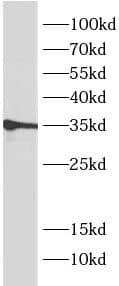 Western Blot MEST Antibody (5E0)