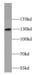 Western Blot: O-GlcNAcase/OGA/MGEA5 Antibody (9B9) [NBP3-42998] - Human brain lysate were subjected to SDS PAGE followed by western blot with (O-GlcNAcase/OGA/MGEA5 antibody) at dilution of 1:600