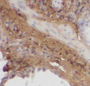 Immunohistochemistry: MGP Antibody (8C3) [NBP3-42999] - Immunohistochemistry of paraffin-embedded human lung using (MGP antibody) at dilution of 1:50