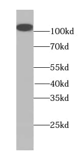 Western Blot: MMS19 like protein Antibody (6H1) [NBP3-43000] - HeLa cells were subjected to SDS PAGE followed by western blot with (MMS19 like protein Antibody) at dilution of 1:2000