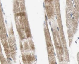 Immunohistochemistry: Myosin heavy chain 2 Antibody (4G9) [NBP3-43001] - Immunohistochemistry of paraffin-embedded human skeletal muscle tissue slide using (Myosin heavy chain 2 Antibody) at dilution of 1:100