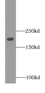 Western Blot Myosin heavy chain 2 Antibody (4G9)