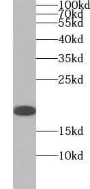 Western Blot: Myosin Light Chain 2 Antibody (1F7) [NBP3-43002] - human heart tissue were subjected to SDS PAGE followed by western blot with (Myosin Light Chain 2 antibody) at dilution of 1:1000