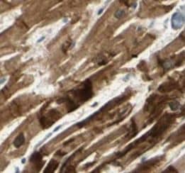 Immunohistochemistry: Myosin Light Chain 2 Antibody (1F7) [NBP3-43002] - Immunohistochemistry of paraffin-embedded human heart slide using (Myosin Light Chain 2 Antibody) at dilution of 1:50