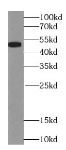 Western Blot NAPRT1 Antibody (0C6)