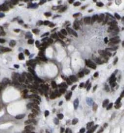 Immunohistochemistry NAPRT1 Antibody (0C6)