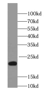 Western Blot: NCALD Antibody (9G5) [NBP3-43004] - human brain tissue were subjected to SDS PAGE followed by western blot with (NCALD antibody) at dilution of 1:1000