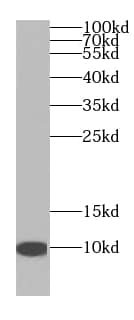 Western Blot: NDUFA4L2 Antibody (0B11) [NBP3-43005] - HeLa cells were subjected to SDS PAGE followed by western blot with (NDUFA4L2 antibody) at dilution of 1:1000